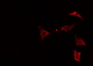 MVK Antibody