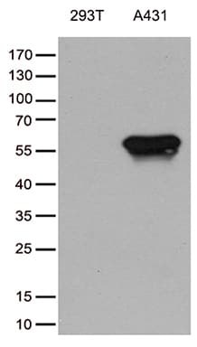 Monoclonal Mouse anti-Human TRIM29 Antibody (clone OTI8D12, aa1-352, IHC, WB)