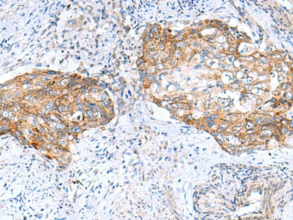 Polyclonal Rabbit anti-Human MRPS28 Antibody (IHC, WB)