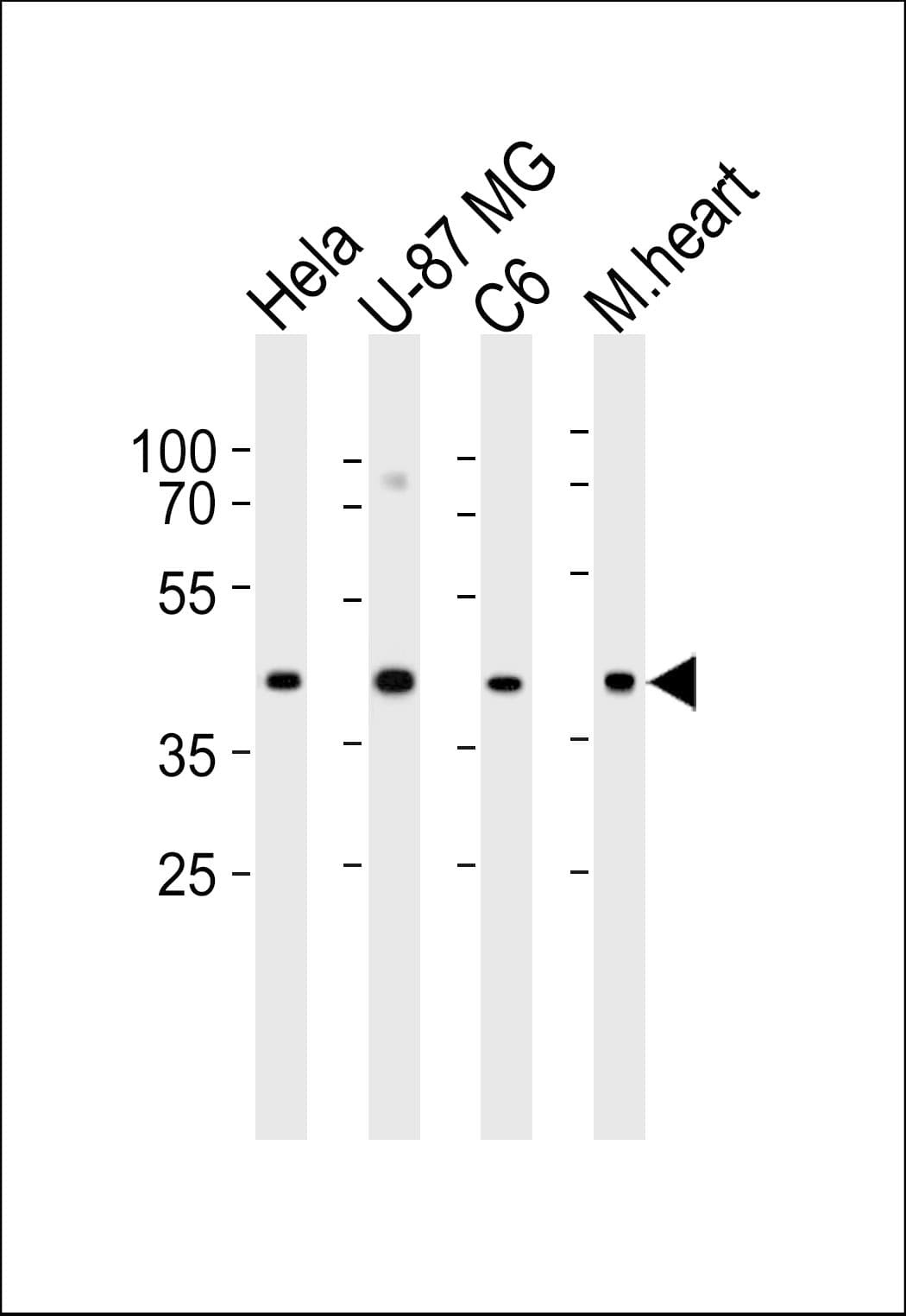 Polyclonal Rabbit anti-Human GJA1 / CX43 / Connexin 43 Antibody (aa107-138, IHC, WB)