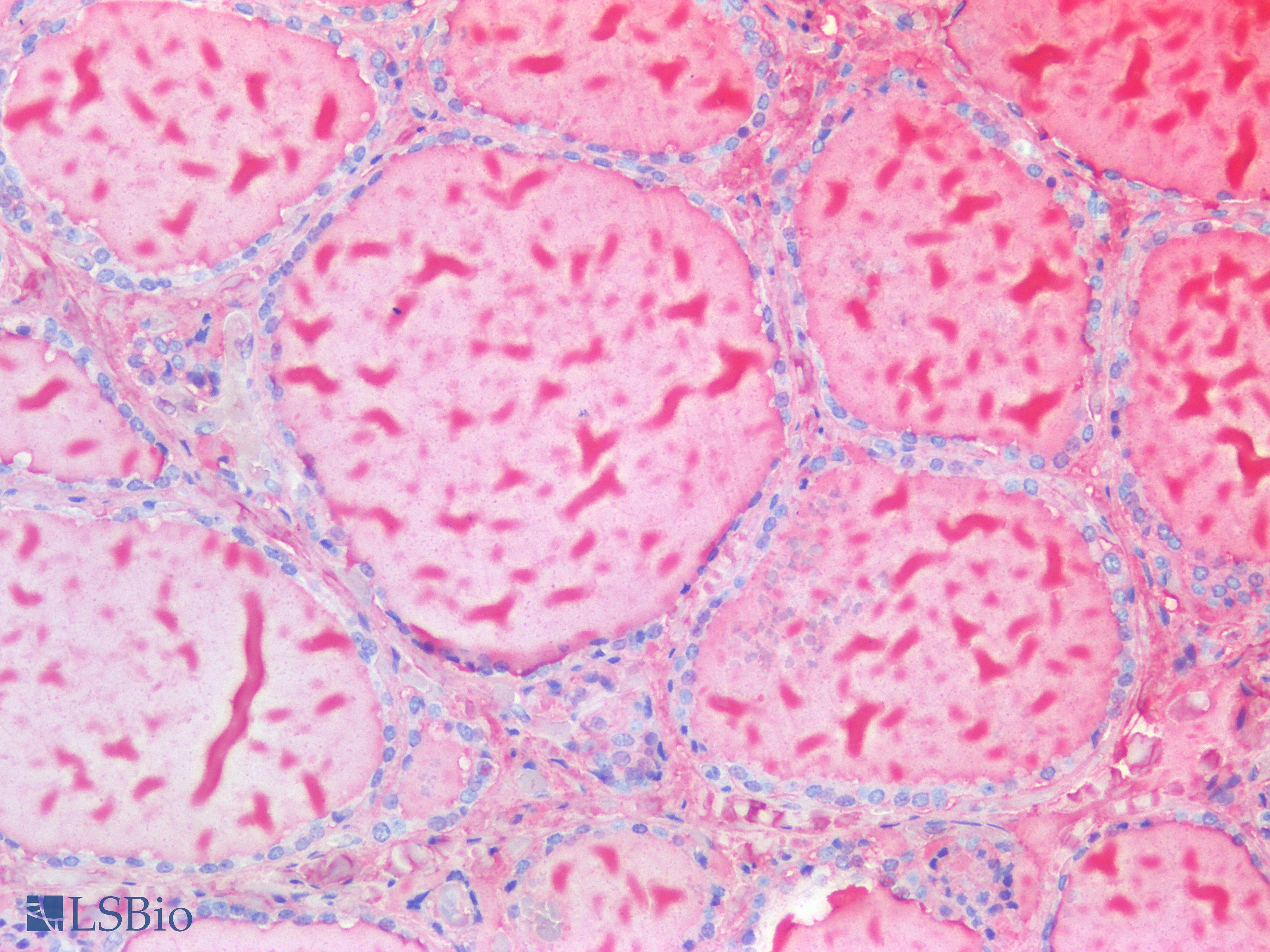 IHC-plus™ TG / Thyroglobulin Antibody