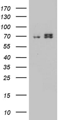 HADHA Antibody (aa106-325, clone OTI7B3)