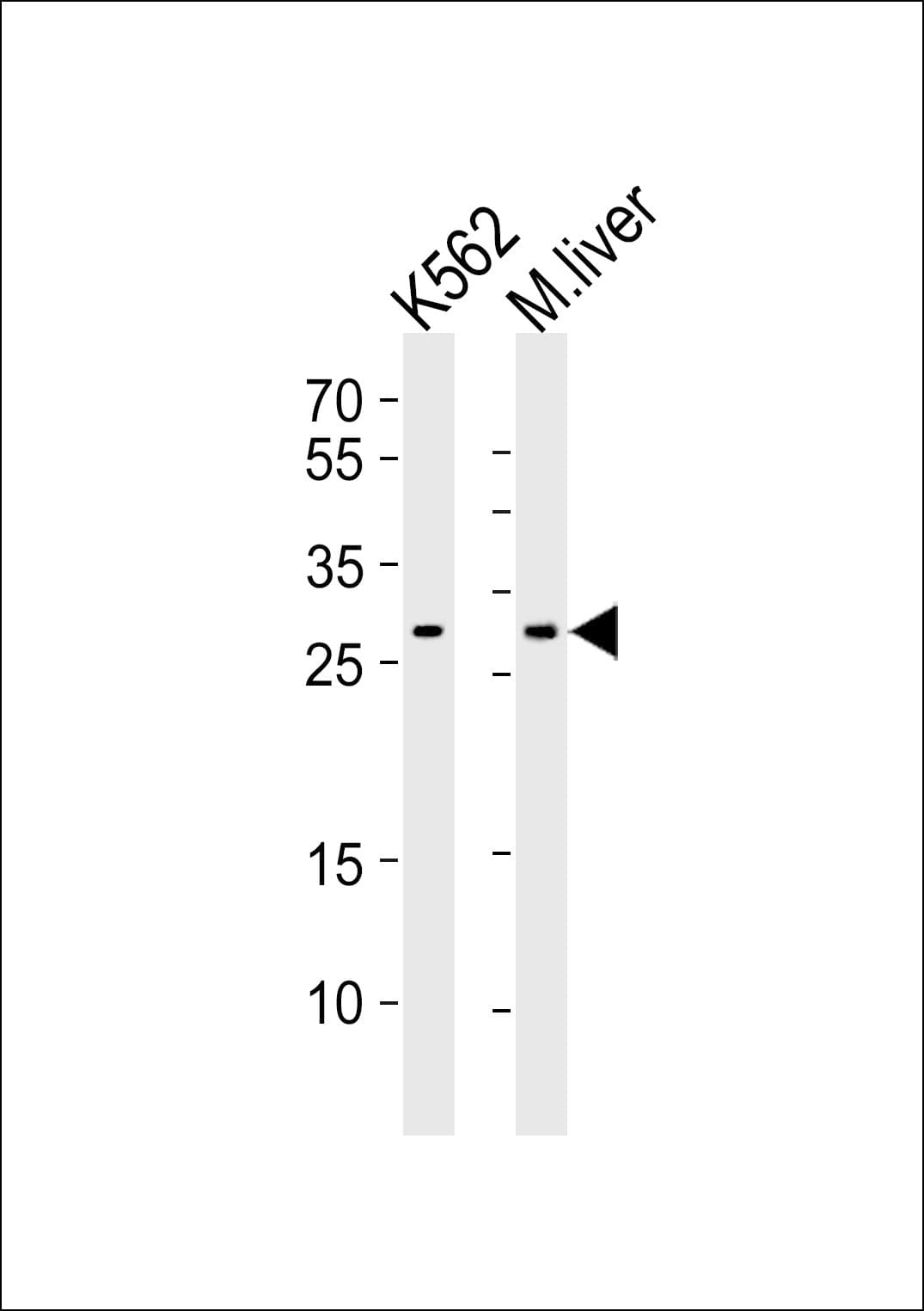 CYB5R2 Antibody (aa33-67)