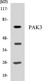 PAK3 Antibody (aa99-148)