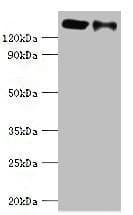 Polyclonal Rabbit anti-Human DIS / CCAR1 Antibody (aa1-200, WB)
