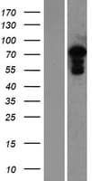 MED25 Protein (Over-Expression Lysate Myc-DDK (Flag))