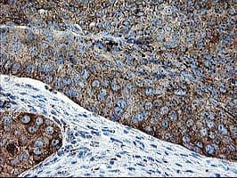 Thymidylate Kinase Antibody (clone OTI1G8)