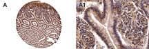 Polyclonal Rabbit anti-Human NOD2 / CARD15 Antibody (IHC, WB)