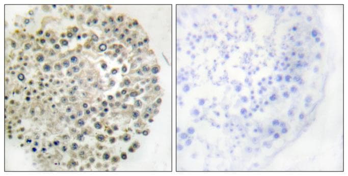 Polyclonal Rabbit anti-Human TRIM16 Antibody (IHC)