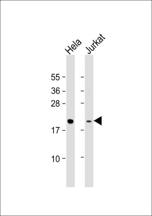 Polyclonal Rabbit anti-Human MRPL48 Antibody (WB)