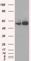 ATP5B / ATP Synthase Beta Antibody (clone OTI7F4)