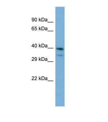 Polyclonal Rabbit anti-Human INPP5J / PIB5PA Antibody (aa208-257, WB)