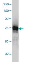 IHC-plus™ IRAK1 / IRAK Antibody (clone 3F7)