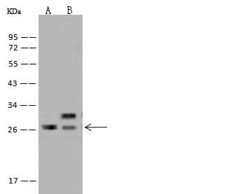HSpc24 / SPBC24 Antibody
