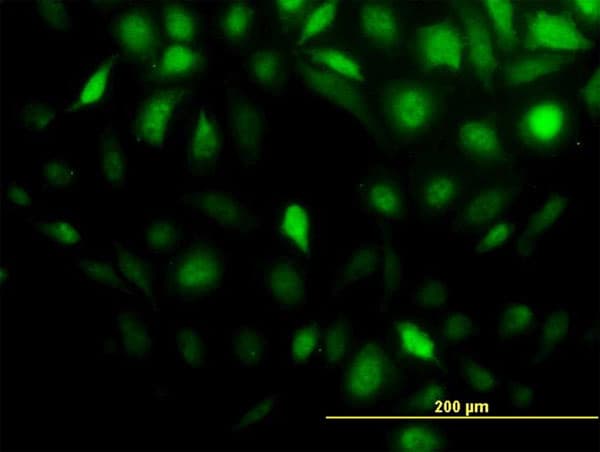 Monoclonal Mouse anti-Human STI1 / STIP1 Antibody (clone 4B6, IF, WB)