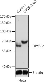 Polyclonal Rabbit anti-Human DPYSL2 / CRMP2 Antibody (WB)