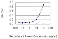 ACTG1 / Gamma Actin Antibody (clone 1G6)