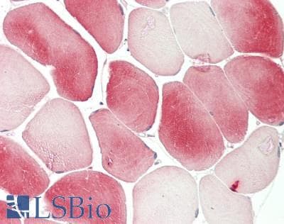 IHC-plus™ Monoclonal Mouse anti-Human TNNT3 Antibody (clone 1F12, IHC, WB)