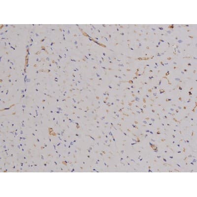 FAK / Focal Adhesion Kinase Antibody (phospho-Tyr576)