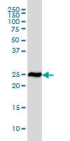 RPL19 / Ribosomal Protein L19 Antibody (clone 3H4)