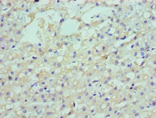 Polyclonal Rabbit anti-Human ARH / LDLRAP1 Antibody (aa59-308, IHC, WB)