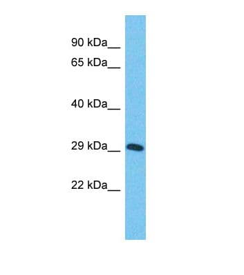 ZNF625 Antibody (aa41-90)