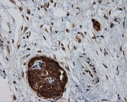BAP / SIL1 Antibody (clone OTI1F9)