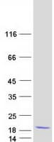Human COMMD6 Protein (Recombinant Myc-DDK (Flag))