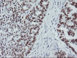 TP53 / p53 Antibody (clone OTI5E2)