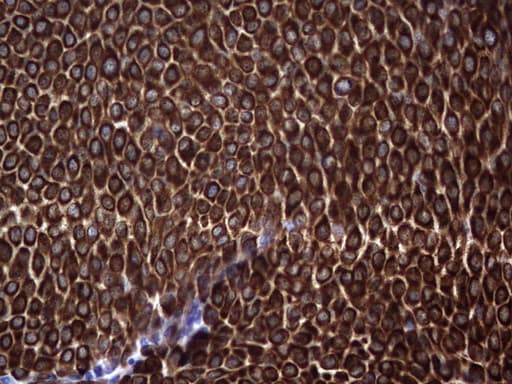 KRT19 / CK19 / Cytokeratin 19 Antibody (aa240-390, clone OTI8A1)