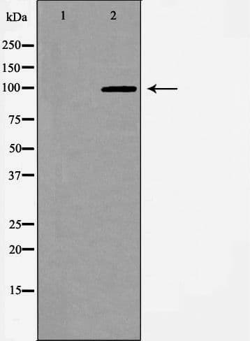 EPHA2 / EPH Receptor A2 Antibody