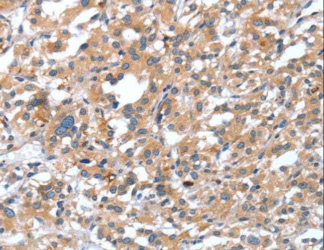 Polyclonal Rabbit anti-Human DSC1 / Desmocollin 1 Antibody (IHC)