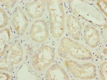 TAMM41 / C3orf31 Antibody