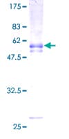 Human LMPB1 / PAQR8 Protein (Recombinant GST)