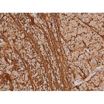 SP1 Antibody (phospho-Thr453)