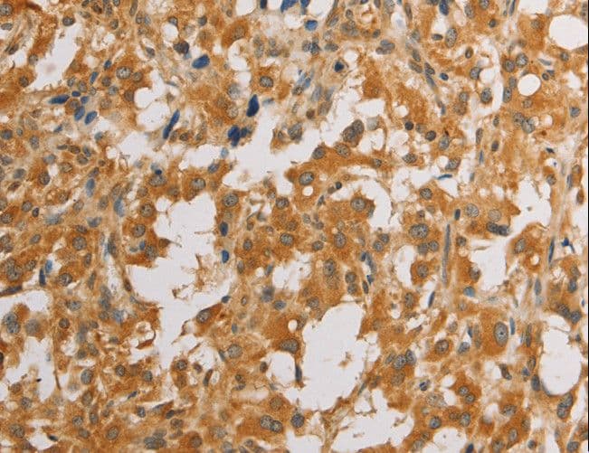 ATG4D Antibody