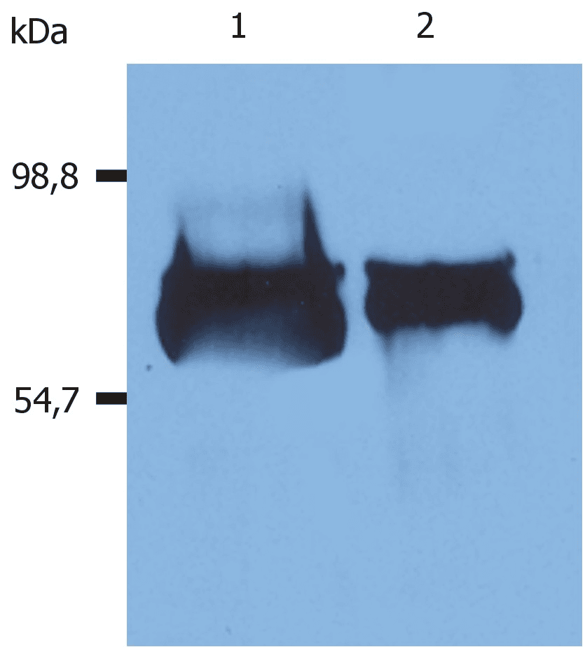 IHC-plus™ Monoclonal Mouse anti-Human ALB / Serum Albumin Antibody (clone AL-01, IHC, WB)