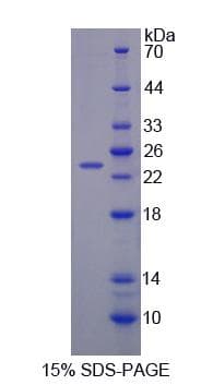 Rat BCKDK Protein (Recombinant His-S)
