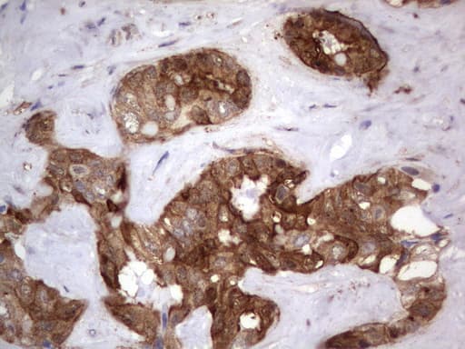LGALS3 / Galectin 3 Antibody (clone UMAB157, Carrier-free)