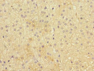CRF2-12 / IL28RA Antibody