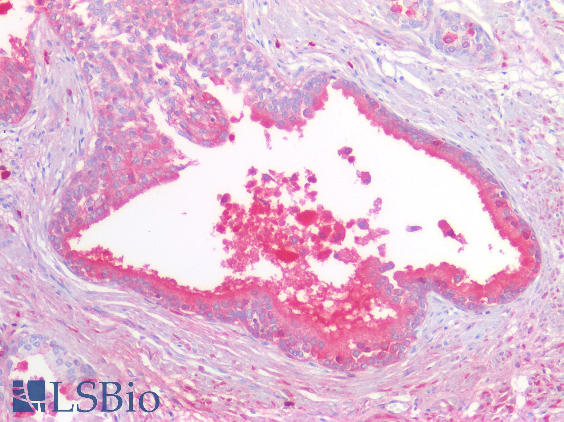 PathPlus™ STK11 / LKB1 Antibody (clone 27D10)