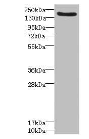 Polyclonal Rabbit anti-Human DEC-205 / CD205 / LY75 Antibody (IHC, WB)