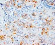 VEGFD Antibody (aa101-115)