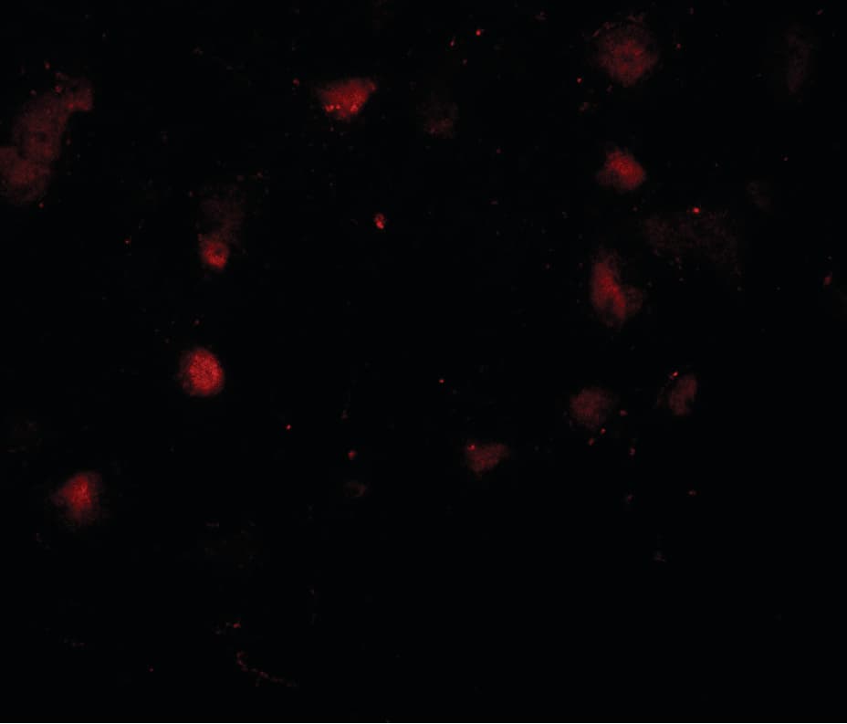 IHC-plus™ CASK Antibody