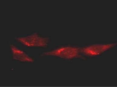 IHC-plus™ TP53 / p53 Antibody (clone BP53-12)
