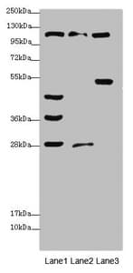 Polyclonal Rabbit anti-Human CORIN Antibody (IHC, WB)