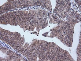 ETS2 Antibody (aa90-349, clone OTI2A3, Carrier-free)