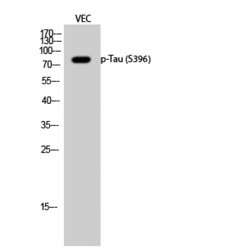 MAPT / Tau Antibody (650-730 aa)