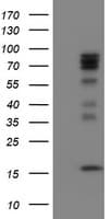CNOT4 / CLONE243 Antibody (clone OTI3B8)