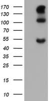 CA12 / Carbonic Anhydrase XII Antibody (clone OTI2E9)